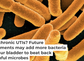 Certain strains of E. coli can outcompete disease-causing microbes for resources. NIAID/Flickr, CC BY-SA